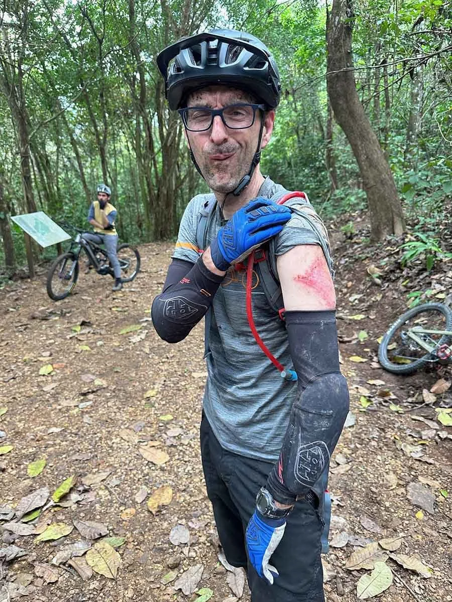 Mountain biker with an injury